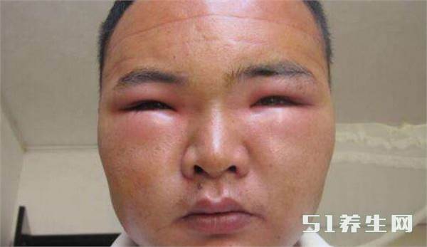 村里小伙臭显摆徒手去采野蜜蜂大意之下发生了这样一幕