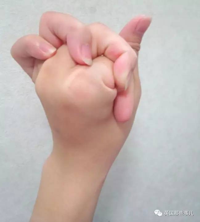 又一股神秘东方力量——花式手指打结…再次让歪果吃瓜网友震惊了