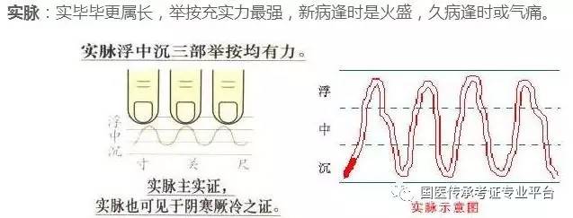 普通人都能学会的,看图学把脉吧,一看就会