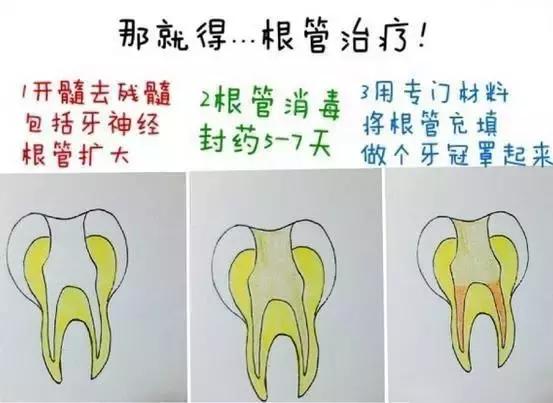 小朋友吃多了糖牙齒裡真的會長蟲嗎怎麼讓它不長蟲呢