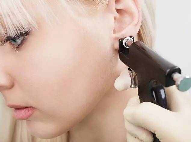 耳钉枪打孔法电穿孔法采用高频多功能电离子治疗机,操作简单,而且不受