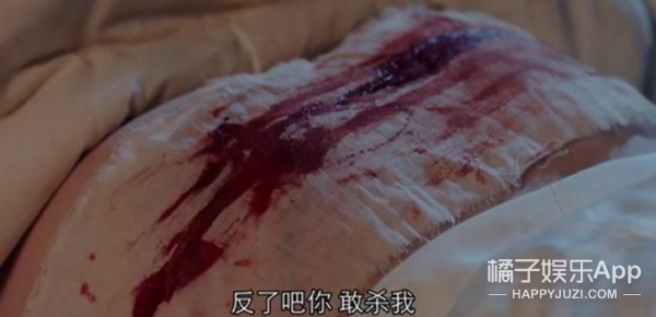 这屁股上血糊糊,还挺严重!