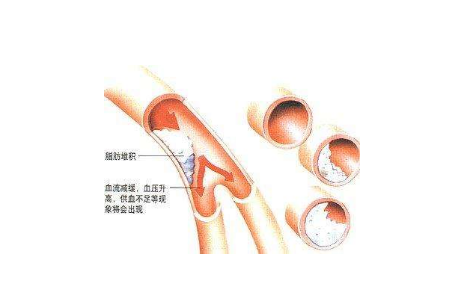 简单几物,疏通血管,一身轻松!
