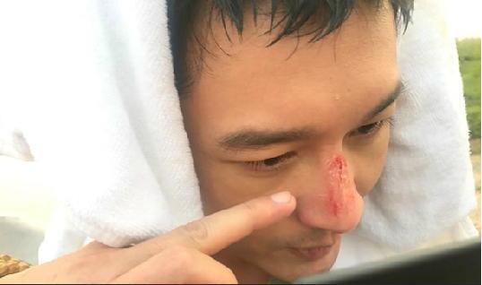 黄晓明拼命拍戏差点毁容,竟还被网友骂惨!