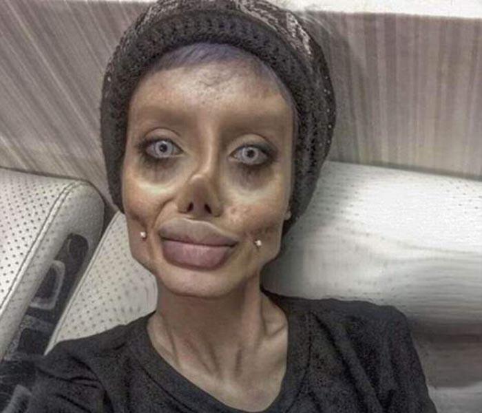 女子欲整容成好莱坞明星 结果却整成了僵尸!