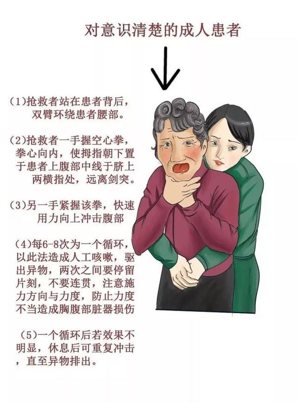 微漫画儿童及成人气道异物梗阻怎么办