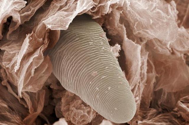 脸上出现5个症状要当心,螨虫"露马脚"了,2招赶尽灭绝