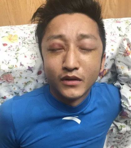 邹市明眼疾初步确诊心疼拳王