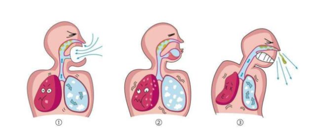 喷嚏反射是指鼻粘膜或鼻咽部受到刺激所引起的一种防御性呼吸反射.