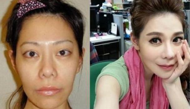 历经22年从少女整容到中年60多次整容，究竟是喜还是悲？_凤凰网娱乐_凤凰网