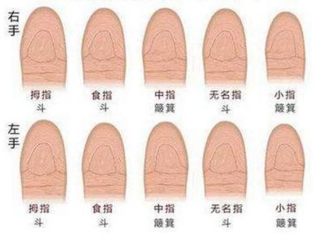 这种指纹的人喜欢广泛收集知识,对人对事更有办法,性格比较强势,但