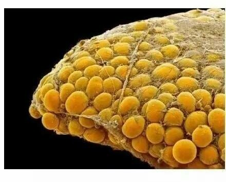 脂肪组织(黄色的是脂肪细胞)
