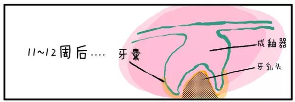 第十周 成釉器下方的外胚间叶细胞开始逐步积聚 使得成釉器的底部