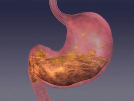 中医养生:如何泡丁香红叶茶好喝又养胃,千年传说就是这么神奇