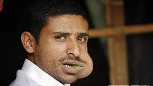 吃东西总是一侧咀嚼,危害有多大?_凤凰网健康_凤凰网