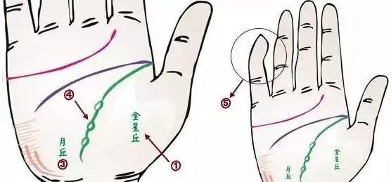 24种手诊图，堪比X光线，揭示你的身心健康_凤凰网健康_凤凰网