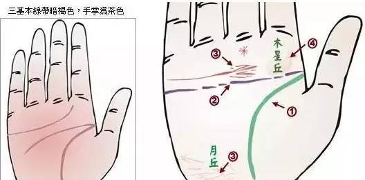 24种手诊图，堪比X光线，揭示你的身心健康_凤凰网健康_凤凰网