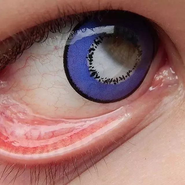 美国女生玩眼睛,各种东西塞进去