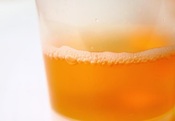 高尿酸出现蛋白尿,小心肾衰竭!1种小植物,是降尿酸的"高手"