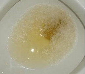 有保糖尿病的保险 有没有保糖尿病的保险