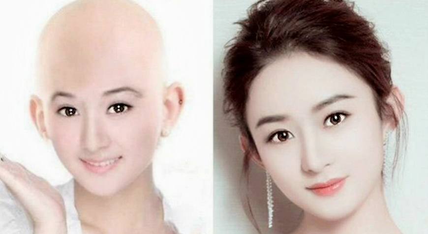 女明星们的光头造型,特别郑爽的