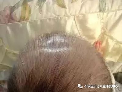 宝宝的囟门什么时候闭合才算是正常的？_凤凰网健康_凤凰网