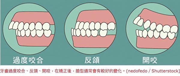 正常牙齿侧面图,标准的牙齿咬合侧面图,牙齿完美咬合图侧面_大山谷图库