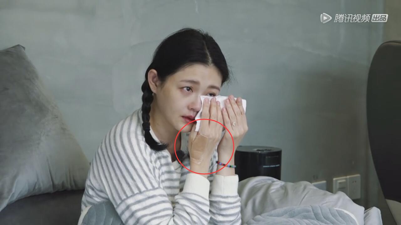 大s手上为什么一直贴着膏药知道真相后网友都笑了