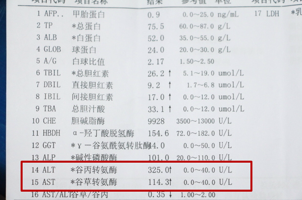 肝炎病变,转氨酶"亮红灯",多喝这杯茶,及时调理降酶止损