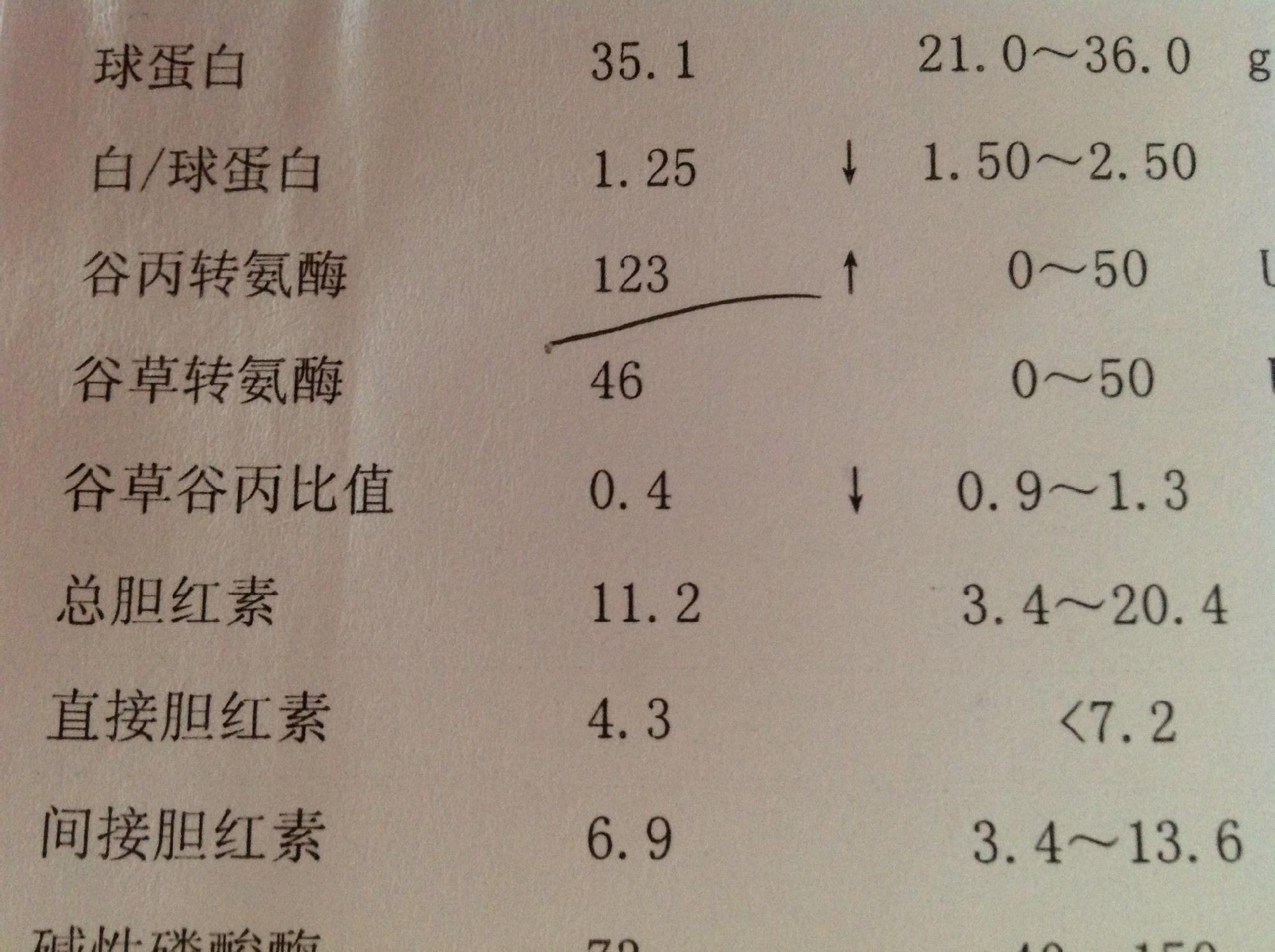 如果轉氨酶的數值長期大於400iu/l一定要注意,即便自己身體沒有出現不