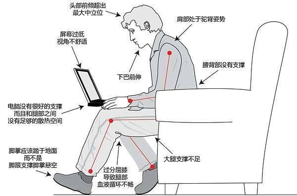 所以改善骨盆前倾