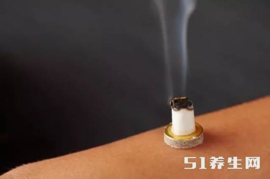 坚持艾灸这组穴位,治好了她的盆腔炎,连医生都替她高兴