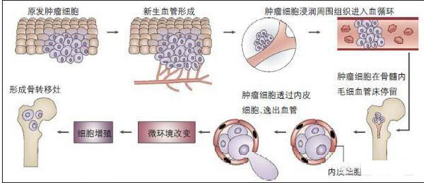 肿瘤细胞转移过程中不仅可以适应新的微环境,还可以通过携带因子等