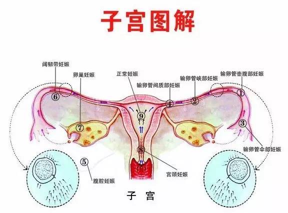 妇科第一瘤子宫肌瘤是怎么来的
