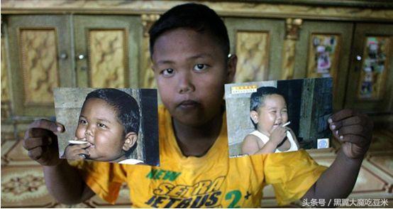 还记得这个抽烟的孩子吗?2岁时把烟当饭吃,如今模样大变