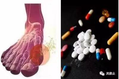 难治性痛风的药物降尿酸方法汇总,终于不用感