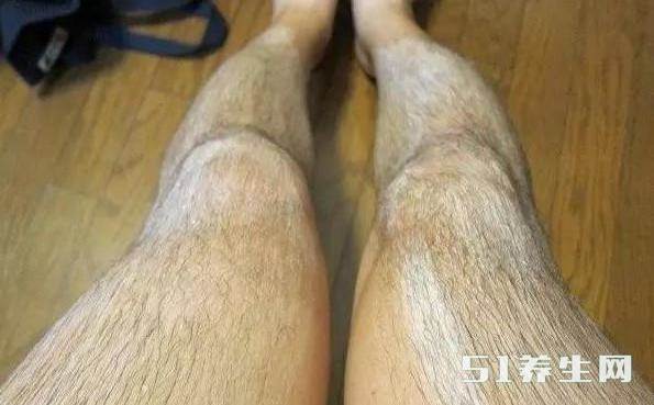 猩猩腿毛图片图片