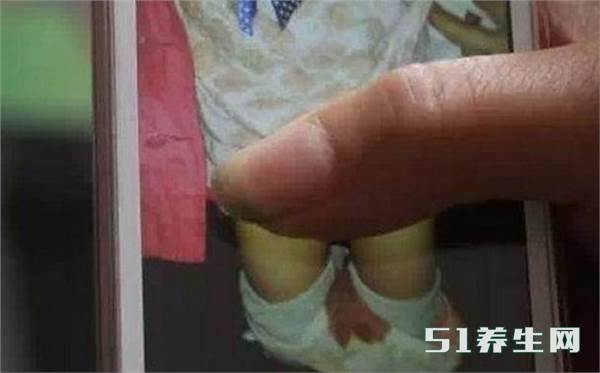 过了个"七夕劫"?女生初次"爱爱"大出血5小时,医生紧急手术!