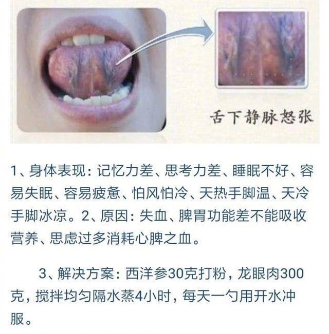 舌头原来是人体健康的"放大镜