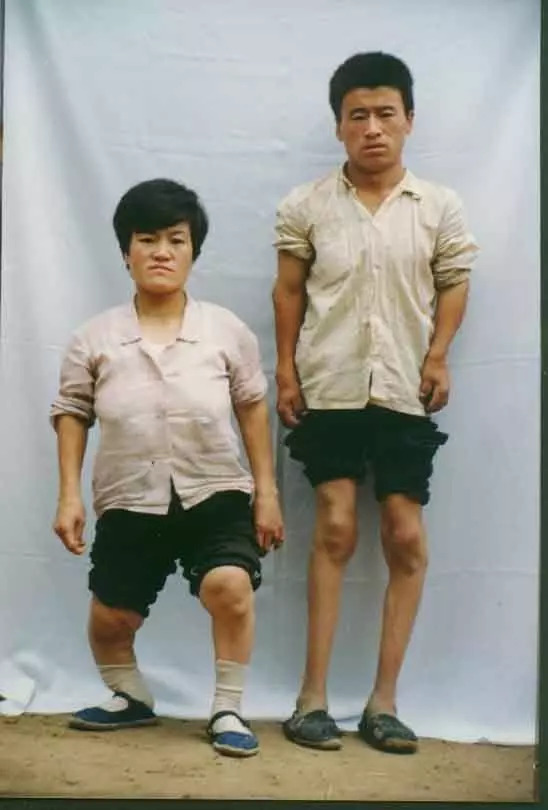 科学补硒——大骨节病你注意了吗?_凤凰网健康_凤凰网