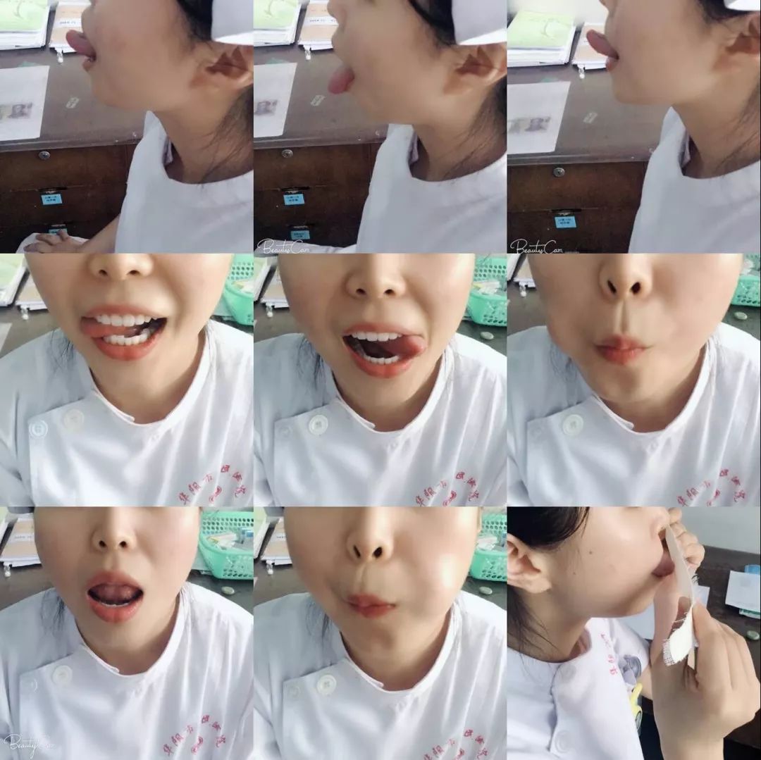 脑血管病人这样康复训练可以尽快开口说话