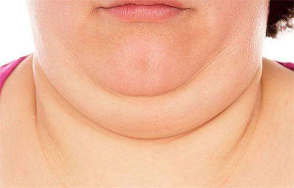 嘘这有一份减掉双下巴的妙招
