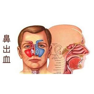 鼻出血:小孩鼻出血莫慌张,如何应对?看过来!__凤凰网
