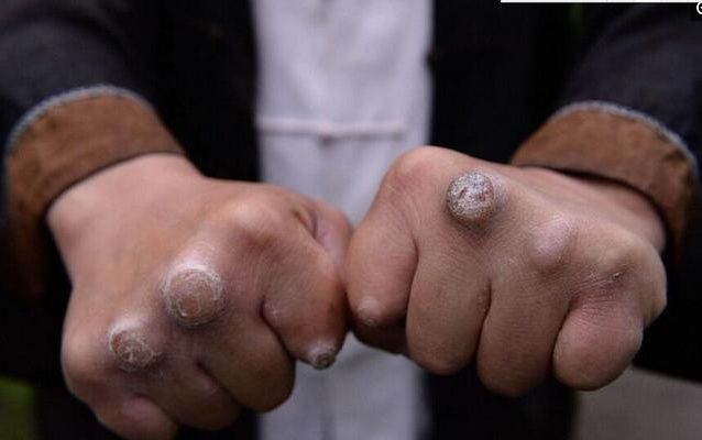 作为传统武术的一种,硬气功却也有着自己的神奇之处,比如铁砂掌劈断