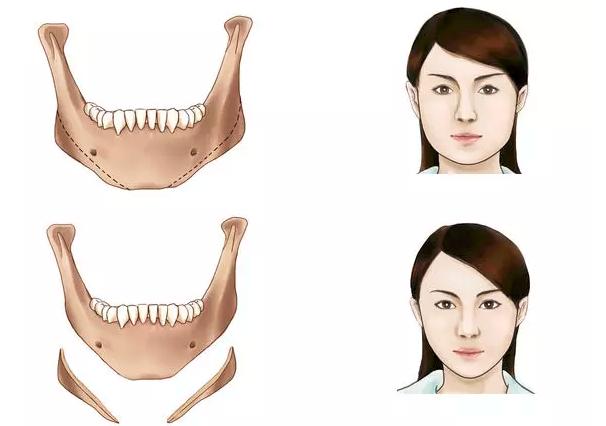 狐狸系男友?小鲜肉脸型是关键