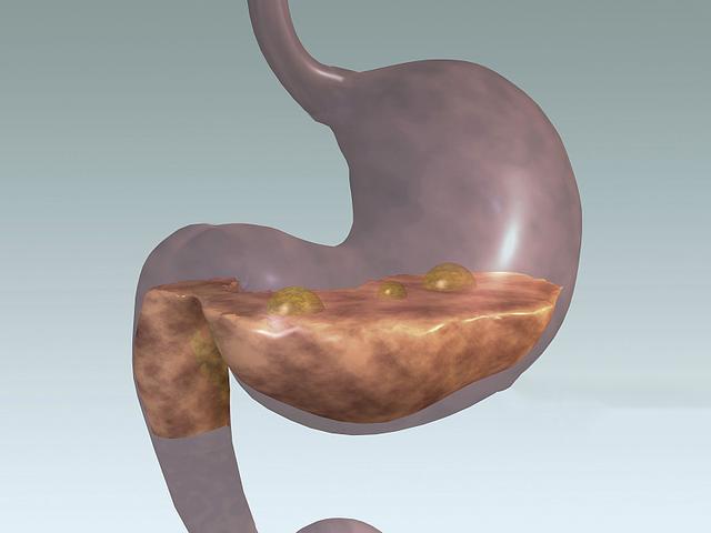 胃不好的人请记住 谨记3喝 2不喝 养胃灭菌 胃也会越来越好