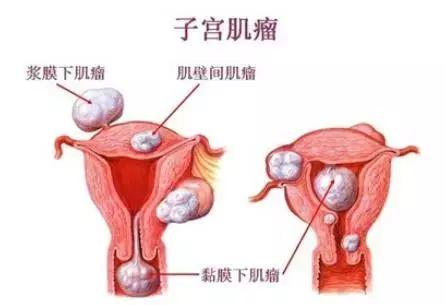 啪了还是痛?要警惕这些疾病