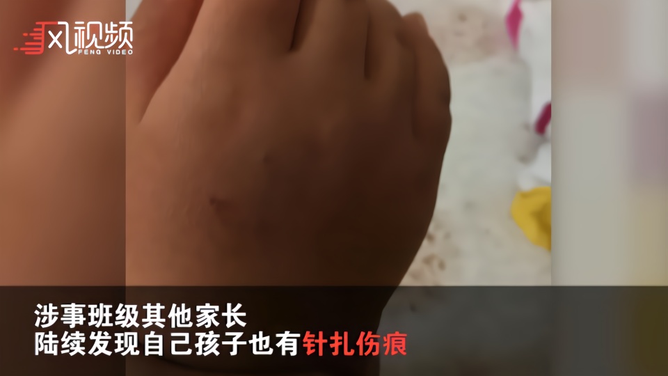 北京一幼儿园孩子被曝遭遇扎针不睡觉扎屁股不写作业扎手