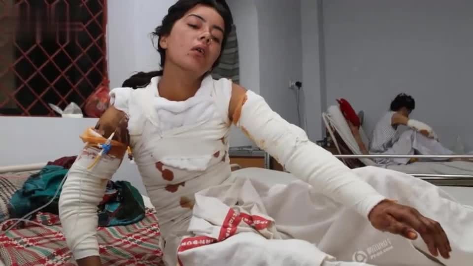 巴基斯坦20岁少女拒绝男子求婚被泼汽油烧死