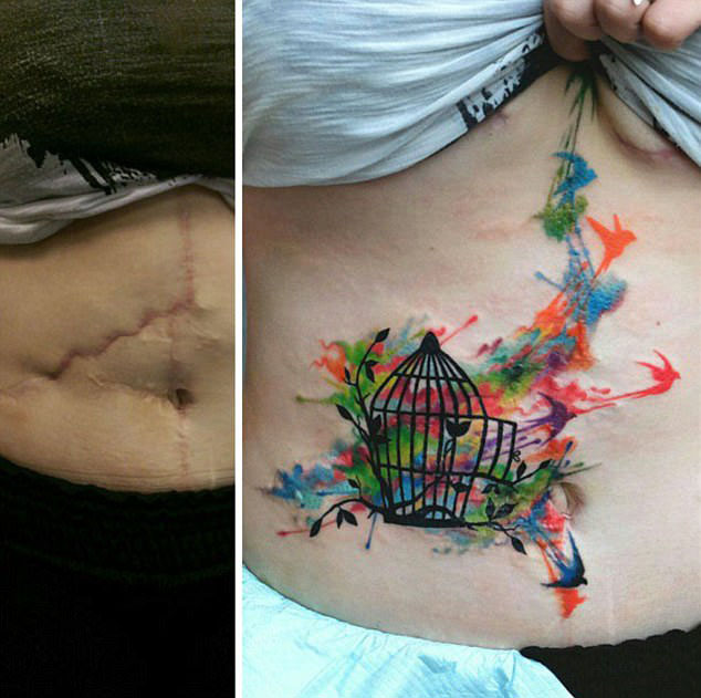 人体艺术!丑陋伤疤巧变精美纹身